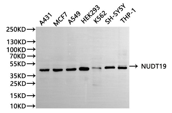 Western Blot
Positive WB detected in: A431 whole cell lysate(30µg), MCF-7 whole cell lysate(30µg), A549 whole cell lysate(30µg), HEK293 whole cell lysate(30µg), K562 whole cell lysate(30µg), SH-SY5Y whole cell lysate(30µg), THP-1 whole cell lysate(30µg)
All lanes: NUDT19 antibody at 1:1000
Secondary
Goat polyclonal to rabbit IgG at 1/40000 dilution
Predicted band size: 42 kDa
Observed band size: 42 kDa
Exposure time：2min