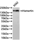 Western Blot
Positive WB detected in: K562 whole cell lysate(30µg) 
All lanes: Hamartin antibody at 1:1000
Secondary
Goat polyclonal to rabbit IgG at 1/40000 dilution
Predicted band size: 130 kDa
Observed band size: 150 kDa
Exposure time：3min