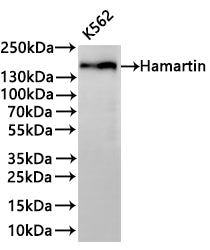 Western Blot
Positive WB detected in: K562 whole cell lysate(30µg) 
All lanes: Hamartin antibody at 1:1000
Secondary
Goat polyclonal to rabbit IgG at 1/40000 dilution
Predicted band size: 130 kDa
Observed band size: 150 kDa
Exposure time：3min