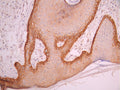 IHC image of CSB-RA049199A0HU diluted at 1:100 and staining in paraffin-embedded human skin tissue performed on a Leica BondTM system. After dewaxing and hydration, antigen retrieval was mediated by high pressure in a citrate buffer (pH 6.0). Section was blocked with 10% normal goat serum 30min at RT. Then primary antibody (1% BSA) was incubated at 4°C overnight. The primary is detected by a Goat anti-rabbit polymer IgG labeled by HRP and visualized using 0.05% DAB.