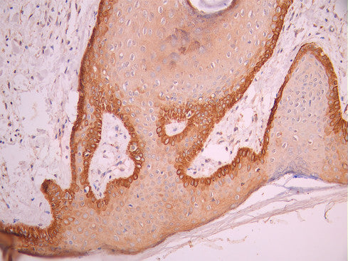IHC image of CSB-RA049199A0HU diluted at 1:100 and staining in paraffin-embedded human skin tissue performed on a Leica BondTM system. After dewaxing and hydration, antigen retrieval was mediated by high pressure in a citrate buffer (pH 6.0). Section was blocked with 10% normal goat serum 30min at RT. Then primary antibody (1% BSA) was incubated at 4°C overnight. The primary is detected by a Goat anti-rabbit polymer IgG labeled by HRP and visualized using 0.05% DAB.