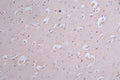 IHC image of CSB-RA050476A0HU diluted at 1:100 and staining in paraffin-embedded human brain tissue performed on a Leica BondTM system. After dewaxing and hydration, antigen retrieval was mediated by high pressure in a citrate buffer (pH 6.0) . Section was blocked with 10% normal goat serum 30min at RT. Then primary antibody (1% BSA) was incubated at 4°C overnight. The primary is detected by a Goat anti-rabbit polymer IgG labeled by HRP and visualized using 0.12% DAB.