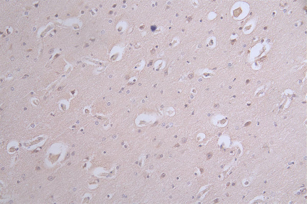 IHC image of CSB-RA050476A0HU diluted at 1:100 and staining in paraffin-embedded human brain tissue performed on a Leica BondTM system. After dewaxing and hydration, antigen retrieval was mediated by high pressure in a citrate buffer (pH 6.0) . Section was blocked with 10% normal goat serum 30min at RT. Then primary antibody (1% BSA) was incubated at 4°C overnight. The primary is detected by a Goat anti-rabbit polymer IgG labeled by HRP and visualized using 0.12% DAB.