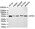 Western Blot
Positive WB detected in: HT-29 whole cell lysate(30µg) , HepG2 whole cell lysate(30µg) ,  HEK293T whole cell lysate(30µg) , SH-SY5Y whole cell lysate(30µg) , NIH/3T3 whole cell lysate(30µg) 
All lanes: ATG5 antibody at 1:1000
Secondary
Goat polyclonal to rabbit IgG at 1/40000 dilution
Predicted band size: 32 kDa
Observed band size: 55 kDa
Exposure time：2min
