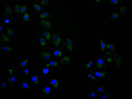 Immunofluorescence staining of Hela cell with CSB-RA051003A0HU at 1:50, counter-stained with DAPI. The cells were fixed in 4% formaldehyde and blocked in 10% normal Goat Serum. The cells were then incubated with the antibody overnight at 4°C. The secondary antibody was Alexa Fluor 488-congugated AffiniPure Goat Anti-Rabbit IgG(H+L) .