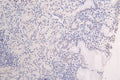 IHC image of CSB-RA051594A0HU diluted at 1:50 and staining in paraffin-embedded human brain tissue performed on a Leica BondTM system. After dewaxing and hydration, antigen retrieval was mediated by high pressure in a citrate buffer (pH 6.0) . Section was blocked with 10% normal goat serum 30min at RT. Then primary antibody (1% BSA) was incubated at 4°C overnight. The primary is detected by a Goat anti-rabbit polymer IgG labeled by HRP and visualized using 0.10% DAB.