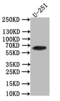 Western Blot
Positive WB detected in: U251 whole cell lysate
All lanes: EAAT2 antibody at 1:1000
Secondary
Goat polyclonal to rabbit IgG at 1/50000 dilution
Predicted band size: 62 kDa
Observed band size: 62 kDa