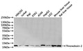 Western Blot
Positive WB detected in: HEK293 whole cell lysate(30µg), Jurkat whole cell lysate(30µg), Raji whole cell lysate(30µg), K562 whole cell lysate(30µg), A549 whole cell lysate(30µg), HepG2 whole cell lysate(30µg), LO2 whole cell lysate(30µg), Mouse liver tissue lysate(30µg), Rat liver tissue lysate(30µg)
All lanes: Thioredoxin 2 antibody at 1:1000
Secondary
Goat polyclonal to rabbit IgG at 1/40000 dilution
Predicted band size: 18 kDa
Observed band size: 12 kDa
Exposure time：2min