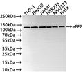 Western Blot
Positive WB detected in: THP-1 whole cell lysate, HepG2 whole cell lysate, Jurkat whole cell lysate(30µg) , HEK293 whole cell lysate, NIH/3T3 whole cell lysate, HeLa whole cell lysate(30µg) 
All lanes: eEF2 antibody at 1:1000
Secondary
Goat polyclonal to rabbit IgG at 1/50000 dilution
Predicted band size: 95 kDa
Observed band size: 115 kDa
Exposure time: 10s