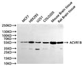 Western Blot, 
Positive WB detected in:MCF7 whole cell lysate(30µg), HEK293 whole cell lysate(30µg), U251 whole cell lysate(30µg), COLO205 whole cell lysate(30µg), Mouse brainr tissue lysate(30µg), Rat brain lysate(30µg)
All lanes: ACVR1B antibody at 1:1000
Secondary
Goat polyclonal to rabbit IgG at 1/40000 dilution
Predicted band size: 57 kDa
Observed band size: 57 kDa
Exposure time：30s
