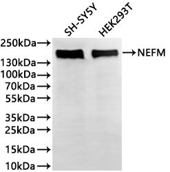 Western Blot
Positive WB detected in: SH-SY5Y whole cell lysate(30µg) , HEK293T whole cell lysate(30µg) 
All lanes: NEFM antibody at 1:1000
Secondary
Goat polyclonal to rabbit IgG at 1/40000 dilution
Predicted band size: 102 kDa
Observed band size: 160 kDa
Exposure time：3min
