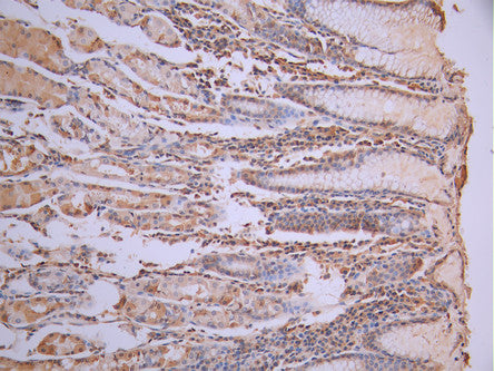IHC image of CSB-RA054513A0HU diluted at 1:100 and staining in paraffin-embedded human stomach tissue performed on a Leica BondTM system. After dewaxing and hydration, antigen retrieval was mediated by high pressure in a citrate buffer (pH 6.0). Section was blocked with 10% normal goat serum 30min at RT. Then primary antibody (1% BSA) was incubated at 4°C overnight. The primary is detected by a Goat anti-rabbit polymer IgG labeled by HRP and visualized using 0.05% DAB.