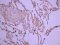 IHC image of CSB-RA055227A0HU diluted at 1:100 and staining in paraffin-embedded human lung tissue performed on a Leica BondTM system. After dewaxing and hydration, antigen retrieval was mediated by high pressure in a citrate buffer (pH 6.0). Section was blocked with 10% normal goat serum 30min at RT. Then primary antibody (1% BSA) was incubated at 4°C overnight. The primary is detected by a Goat anti-rabbit polymer IgG labeled by HRP and visualized using 0.05% DAB.