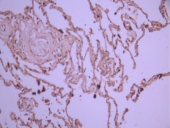 IHC image of CSB-RA055227A0HU diluted at 1:100 and staining in paraffin-embedded human lung tissue performed on a Leica BondTM system. After dewaxing and hydration, antigen retrieval was mediated by high pressure in a citrate buffer (pH 6.0). Section was blocked with 10% normal goat serum 30min at RT. Then primary antibody (1% BSA) was incubated at 4°C overnight. The primary is detected by a Goat anti-rabbit polymer IgG labeled by HRP and visualized using 0.05% DAB.