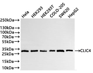 Western Blot
Positive WB detected in: Hela whole cell lysate(20µg) ,HEK293 whole cell lysate(20µg) , HEK293T whole cell lysate(20µg) , COLO-205 whole cell lysate(20µg) ,SW620 whole cell lysate(20µg) ,HepG2 whole cell lysate(20µg) 
All lanes: CLIC4 antibody at 1:1000
Secondary
Goat polyclonal to rabbit IgG at 1/40000 dilution
Predicted band size: 29 kDa
Observed band size: 29 kDa
Exposure time：3min