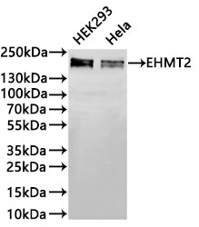 Western Blot
Positive WB detected in: HEK293 whole cell lysate(20µg) ,Hela whole cell lysate(20µg) 
All lanes: EHMT2 antibody at 1:1000
Secondary
Goat polyclonal to rabbit IgG at 1/40000 dilution
Predicted band size: 132 kDa
Observed band size: 160/170 kDa
Exposure time：1min20s