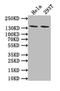 Western Blot
Positive WB detected in: Hela whole cell lysate, 293T whole cell lysate
All lanes: EBI3 antibody at 1:1000
Secondary
Goat polyclonal to rabbit IgG at 1/50000 dilution
Predicted band size: 140 kDa
Observed band size: 140 kDa