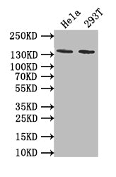Western Blot
Positive WB detected in: Hela whole cell lysate, 293T whole cell lysate
All lanes: EBI3 antibody at 1:1000
Secondary
Goat polyclonal to rabbit IgG at 1/50000 dilution
Predicted band size: 140 kDa
Observed band size: 140 kDa
