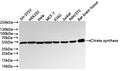 Western Blot
Positive WB detected in: SH-SY5Y whole cell lysate(30µg) , HEK293 whole cell lysate(30µg) , Hela whole cell lysate(30µg) , MCF-7 whole cell lysate(30µg) , K562 whole cell lysate(30µg) , Jurkat whole cell lysate(30µg) , NIH/3T3 whole cell lysate(30µg) , Rat brain tissue lysate(30µg) 
All lanes: Citrate synthase antibody at 1:1000
Secondary
Goat polyclonal to rabbit IgG at 1/40000 dilution
Predicted band size: 52 kDa
Observed band size: 52 kDa
Exposure time：20s