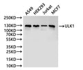 Western Blot
Positive WB detected in: A549 whole cell lysate(30µg), HEK293 whole cell lysate(30µg), Jurkat whole cell lysate(30µg), MCF-7 whole cell lysate(30µg)
All lanes: ULK1 antibody at 1:1000
Secondary
Goat polyclonal to rabbit IgG at 1/40000 dilution
Predicted band size: 113 kDa
Observed band size: 130 kDa
Exposure time：2min