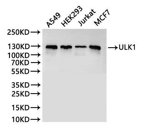 Western Blot
Positive WB detected in: A549 whole cell lysate(30µg), HEK293 whole cell lysate(30µg), Jurkat whole cell lysate(30µg), MCF-7 whole cell lysate(30µg)
All lanes: ULK1 antibody at 1:1000
Secondary
Goat polyclonal to rabbit IgG at 1/40000 dilution
Predicted band size: 113 kDa
Observed band size: 130 kDa
Exposure time：2min