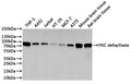 Western Blot
Positive WB detected in: THP-1 whole cell lysate(30µg), A431 whole cell lysate(30µg), Jurkat whole cell lysate(30µg), HT-29 whole cell lysate(30µg), MCF7 whole cell lysate(30µg), A375 whole cell lysate(30µg), Mouse brain tissue lysate(30µg), Rat brain tissue lysate(30µg)
All lanes: PKC delta/theta antibody at 1:1000
Secondary
Goat polyclonal to rabbit IgG at 1/40000 dilution
Predicted band size: 78 kDa
Observed band size: 78 kDa
Exposure time：2min