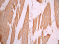 IHC image of CSB-RA058285A0HU diluted at 1:100 and staining in paraffin-embedded human skeletal muscle tissue performed on a Leica BondTM system. After dewaxing and hydration, antigen retrieval was mediated by high pressure in a citrate buffer (pH 6.0). Section was blocked with 10% normal goat serum 30min at RT. Then primary antibody (1% BSA) was incubated at 4°C overnight. The primary is detected by a Goat anti-rabbit polymer IgG labeled by HRP and visualized using 0.05% DAB.