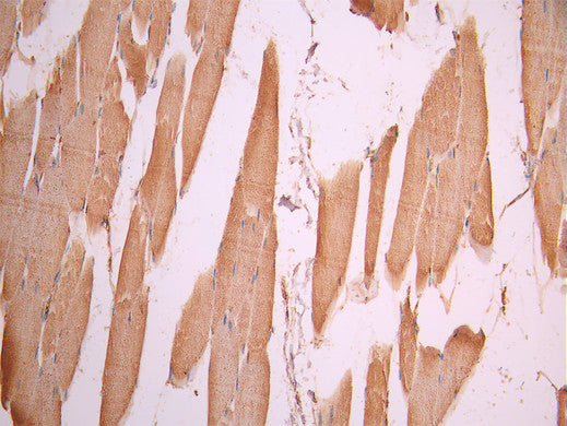 IHC image of CSB-RA058285A0HU diluted at 1:100 and staining in paraffin-embedded human skeletal muscle tissue performed on a Leica BondTM system. After dewaxing and hydration, antigen retrieval was mediated by high pressure in a citrate buffer (pH 6.0). Section was blocked with 10% normal goat serum 30min at RT. Then primary antibody (1% BSA) was incubated at 4°C overnight. The primary is detected by a Goat anti-rabbit polymer IgG labeled by HRP and visualized using 0.05% DAB.