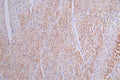 IHC image of CSB-RA058699A0HU diluted at 1:50 and staining in paraffin-embedded human heart tissue performed on a Leica BondTM system. After dewaxing and hydration, antigen retrieval was mediated by high pressure in a citrate buffer (pH 6.0) . Section was blocked with 10% normal goat serum 30min at RT. Then primary antibody (1% BSA) was incubated at 4°C overnight. The primary is detected by a Goat anti-rabbit polymer IgG labeled by HRP and visualized using 0.16% DAB.