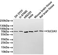 Western Blot
Positive WB detected in: SH-SY5Y whole cell lysate(30µg) , U-87MG whole cell lysate(30µg) , HEK293 whole cell lysate(30µg) , Hela whole cell lysate(30µg) , Mouse brain tissue lysate(30µg) , Rat brain tissue lysate(30µg) 
All lanes: PKC epsilon polymerase beta antibody at 1:1000
Secondary
Goat polyclonal to rabbit IgG at 1/40000 dilution
Predicted band size: 85 kDa
Observed band size: 70-75 kDa
Exposure time：10s