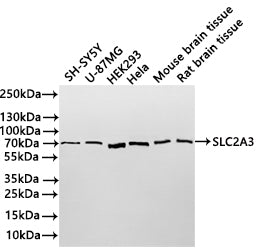 Western Blot
Positive WB detected in: SH-SY5Y whole cell lysate(30µg) , U-87MG whole cell lysate(30µg) , HEK293 whole cell lysate(30µg) , Hela whole cell lysate(30µg) , Mouse brain tissue lysate(30µg) , Rat brain tissue lysate(30µg) 
All lanes: PKC epsilon polymerase beta antibody at 1:1000
Secondary
Goat polyclonal to rabbit IgG at 1/40000 dilution
Predicted band size: 85 kDa
Observed band size: 70-75 kDa
Exposure time：10s
