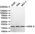 Western Blot
Positive WB detected in: A549 whole cell lysate(30µg) , Hela whole cell lysate(30µg) , MCF-7 whole cell lysate(30µg) 
All lanes: NDK A antibody at 1:1000
Secondary
Goat polyclonal to rabbit IgG at 1/40000 dilution
Predicted band size: 17 kDa
Observed band size: 17 kDa
Exposure time：1min