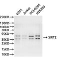 Western Blot, 
Positive WB detected in:U251 whole cell lysate(30µg), Jurkat whole cell lysate(30µg), COLO205 whole cell lysate(30µg), HEK293 whole cell lysate(30µg)
All lanes: SIRT2 antibody at 1:1000
Secondary
Goat polyclonal to rabbit IgG at 1/40000 dilution
Predicted band size: 43 kDa
Observed band size: 36, 43 kDa
Exposure time：120s