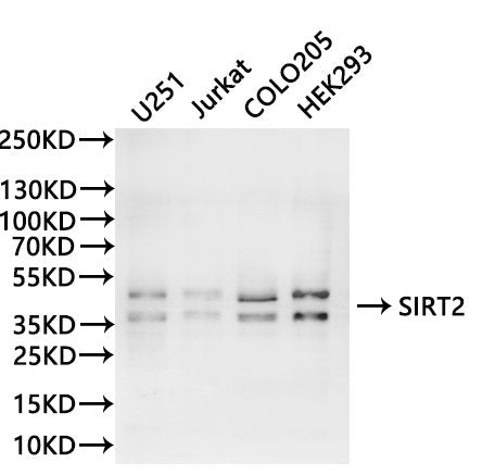 Western Blot, 
Positive WB detected in:U251 whole cell lysate(30µg), Jurkat whole cell lysate(30µg), COLO205 whole cell lysate(30µg), HEK293 whole cell lysate(30µg)
All lanes: SIRT2 antibody at 1:1000
Secondary
Goat polyclonal to rabbit IgG at 1/40000 dilution
Predicted band size: 43 kDa
Observed band size: 36, 43 kDa
Exposure time：120s