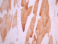 IHC image of CSB-RA062281A0HU diluted at 1:100 and staining in paraffin-embedded human skeletal muscle tissue performed on a Leica BondTM system. After dewaxing and hydration, antigen retrieval was mediated by high pressure in a citrate buffer (pH 6.0). Section was blocked with 10% normal goat serum 30min at RT. Then primary antibody (1% BSA) was incubated at 4°C overnight. The primary is detected by a Goat anti-rabbit polymer IgG labeled by HRP and visualized using 0.05% DAB.