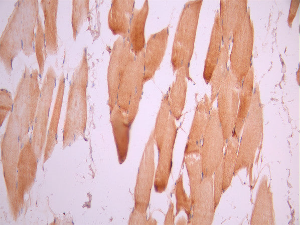 IHC image of CSB-RA062281A0HU diluted at 1:100 and staining in paraffin-embedded human skeletal muscle tissue performed on a Leica BondTM system. After dewaxing and hydration, antigen retrieval was mediated by high pressure in a citrate buffer (pH 6.0). Section was blocked with 10% normal goat serum 30min at RT. Then primary antibody (1% BSA) was incubated at 4°C overnight. The primary is detected by a Goat anti-rabbit polymer IgG labeled by HRP and visualized using 0.05% DAB.