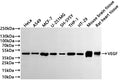 Western Blot
Positive WB detected in: HeLa whole cell lysate(30µg) , A549 whole cell lysate(30µg) , MCF-7 whole cell lysate(30µg) , U-251MG whole cell lysate(30µg) , SH-SY5Y whole cell lysate(30µg) , THP-1 whole cell lysate(30µg) , HT-29 whole cell lysate(30µg) , Mouse brain tissue lysate(30µg) , Rat heart tissue lysate(30µg) 
All lanes: VEGFD antibody at 1:1000
Secondary
Goat polyclonal to rabbit IgG at 1/40000 dilution
Predicted band size: 40 kDa
Observed band size: 40 kDa
Exposure time：2min