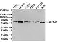 Western Blot
Positive WB detected in: K562 whole cell lysate(30µg) , MCF-7 whole cell lysate(30µg) , Jurkat whole cell lysate(30µg) , A549 whole cell lysate(30µg) , HEK293 whole cell lysate(30µg) , Hela whole cell lysate(30µg) 
All lanes:G6PD antibody at 1:1000
Secondary
Goat polyclonal to rabbit IgG at 1/40000 dilution
Predicted band size: 59 kDa
Observed band size: 59 kDa
Exposure time：2min40s