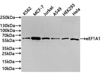 Western Blot
Positive WB detected in: K562 whole cell lysate(30µg) , MCF-7 whole cell lysate(30µg) , Jurkat whole cell lysate(30µg) , A549 whole cell lysate(30µg) , HEK293 whole cell lysate(30µg) , Hela whole cell lysate(30µg) 
All lanes:G6PD antibody at 1:1000
Secondary
Goat polyclonal to rabbit IgG at 1/40000 dilution
Predicted band size: 59 kDa
Observed band size: 59 kDa
Exposure time：2min40s