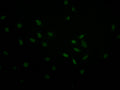 Immunofluorescence staining of MCF-7 with CSB-RA067358A0HU at 1:30, counter-stained with DAPI. The cells were fixed in 4% formaldehyde and blocked in 10% normal Goat Serum. The cells were then incubated with the antibody overnight at 4°C. The secondary antibody was Alexa Fluor 493-congugated AffiniPure Goat Anti-Rabbit IgG(H+L) .