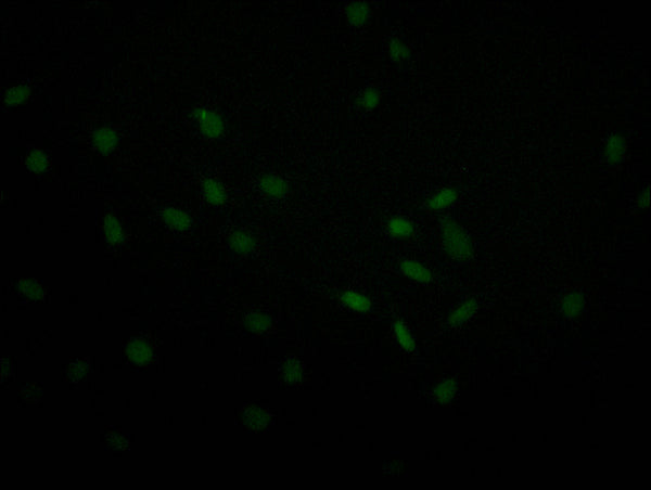 Immunofluorescence staining of MCF-7 with CSB-RA067358A0HU at 1:30, counter-stained with DAPI. The cells were fixed in 4% formaldehyde and blocked in 10% normal Goat Serum. The cells were then incubated with the antibody overnight at 4°C. The secondary antibody was Alexa Fluor 493-congugated AffiniPure Goat Anti-Rabbit IgG(H+L) .