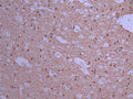 IHC image of CSB-RA067688A0HU diluted at 1:100 and staining in paraffin-embedded human brain tissue performed on a Leica BondTM system. After dewaxing and hydration, antigen retrieval was mediated by high pressure in a citrate buffer (pH 6.0) . Section was blocked with 10% normal goat serum 30min at RT. Then primary antibody (1% BSA) was incubated at 4°C overnight. The primary is detected by a Goat anti-rabbit polymer IgG labeled by HRP and visualized using 0.05% DAB.