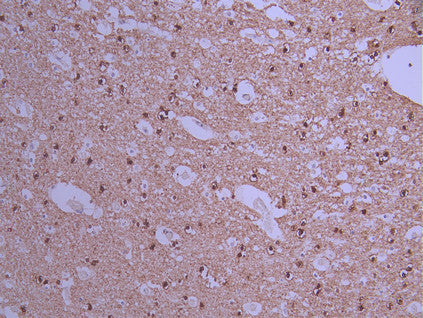 IHC image of CSB-RA067688A0HU diluted at 1:100 and staining in paraffin-embedded human brain tissue performed on a Leica BondTM system. After dewaxing and hydration, antigen retrieval was mediated by high pressure in a citrate buffer (pH 6.0) . Section was blocked with 10% normal goat serum 30min at RT. Then primary antibody (1% BSA) was incubated at 4°C overnight. The primary is detected by a Goat anti-rabbit polymer IgG labeled by HRP and visualized using 0.05% DAB.