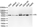 Western Blot
Positive WB detected in: K562 whole cell lysate(30µg) , JURKAT whole cell lysate(30µg) ,MCF-7 whole cell lysate(30µg) ,Hela whole cell lysate(30µg) ,COLO-205 whole cell lysate(30µg) ,A549 whole cell lysate(20µg) ,HepG2 whole cell lysate(30µg) 
All lanes: TR antibody at 1:1000
Secondary
Goat polyclonal to rabbit IgG at 1/40000 dilution
Predicted band size: 71 kDa
Observed band size: 57 kDa
Exposure time：2min