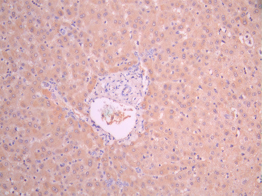 IHC image of CSB-RA06899MA1HU diluted at 1:50 and staining in paraffin-embedded human liver tissue performed on a Leica BondTM system. After dewaxing and hydration, antigen retrieval was mediated by high pressure in a citrate buffer (pH 6.0). Section was blocked with 10% normal goat serum 30min at RT. Then primary antibody (1% BSA) was incubated at 4°C overnight. The primary is detected by a Anti-Human lgG, Fcy Fragment Specific labeled by HRP and visualized using 0.05% DAB.