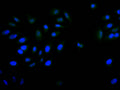 Immunofluorescence staining of A549 with CSB-RA069971A0HU at 1:20, counter-stained with DAPI. The cells were fixed in 4% formaldehyde and blocked in 10% normal Goat Serum. The cells were then incubated with the antibody overnight at 4°C. The secondary antibody was Alexa Fluor 520-congugated AffiniPure Goat Anti-Rabbit IgG(H+L) .