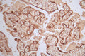 IHC image of CSB-RA071064A0HU diluted at 1:100 and staining in paraffin-embedded human placenta tissue performed on a Leica BondTM system. After dewaxing and hydration, antigen retrieval was mediated by high pressure in a citrate buffer (pH 6.0) . Section was blocked with 10% normal goat serum 30min at RT. Then primary antibody (1% BSA) was incubated at 4°C overnight. The primary is detected by a Goat anti-rabbit polymer IgG labeled by HRP and visualized using 0.50% DAB.
