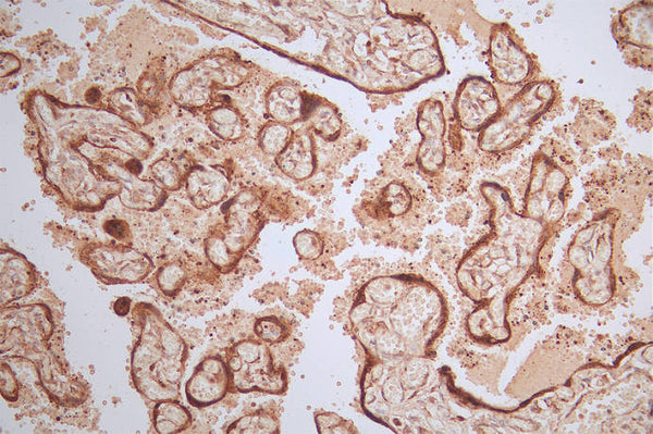 IHC image of CSB-RA071064A0HU diluted at 1:100 and staining in paraffin-embedded human placenta tissue performed on a Leica BondTM system. After dewaxing and hydration, antigen retrieval was mediated by high pressure in a citrate buffer (pH 6.0) . Section was blocked with 10% normal goat serum 30min at RT. Then primary antibody (1% BSA) was incubated at 4°C overnight. The primary is detected by a Goat anti-rabbit polymer IgG labeled by HRP and visualized using 0.50% DAB.