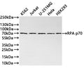 Western Blot
Positive WB detected in: K562 whole cell lysate(20µg) ,Jurkat whole cell lysate(20µg) ,U-251MG whole cell lysate(20µg) ,Hela whole cell lysate(20µg) ,HEK293 whole cell lysate(20µg) 
All lanes: RPA p70 antibody at 1:1000
Secondary
Goat polyclonal to rabbit IgG at 1/40000 dilution
Predicted band size: 68 kDa
Observed band size: 70 kDa
Exposure time：2min