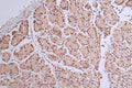 IHC image of CSB-RA072684A0HU diluted at 1:50 and staining in paraffin-embedded human stomach tissue performed on a Leica BondTM system. After dewaxing and hydration, antigen retrieval was mediated by high pressure in a citrate buffer (pH 6.0) . Section was blocked with 10% normal goat serum 30min at RT. Then primary antibody (1% BSA) was incubated at 4°C overnight. The primary is detected by a Goat anti-rabbit polymer IgG labeled by HRP and visualized using 0.32% DAB.